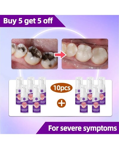 tooh Decay repair Suitable for all ages
