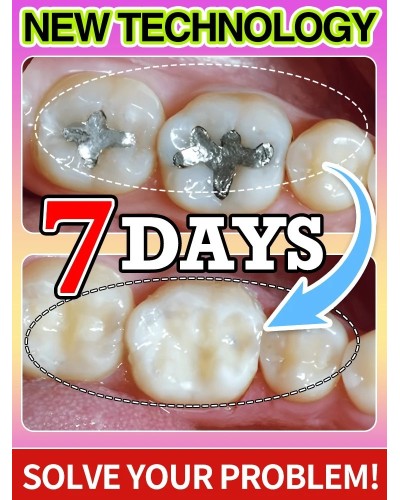 tooh Decay repair Suitable for all ages