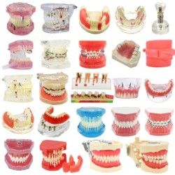 Dental Teeth Model Implant with Removable Dental Education Model for Dentistry Laboratory Demo Studying Dentistry Products Tool