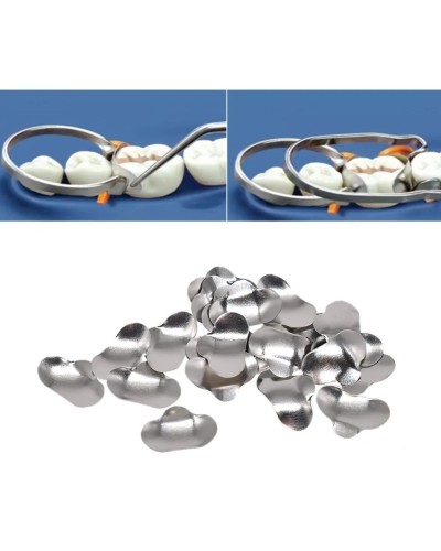 Dental Matrix No.1.398 Sectional Contoured Metal Matrices for Teeth Replacement Dentist Matrix Ring Sell separately