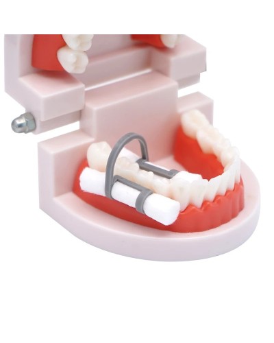 Dental Disposable Cotton Rolls and Plastic Clip Isolator Tool for Teeth Whitening Dentistry Clinic Consumables