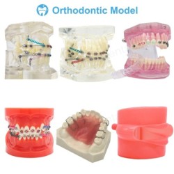 Dental Teeth Model Implant with Removable Dental Education Model for Dentistry Laboratory Demo Studying Dentistry Products Tool