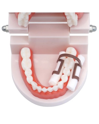 Dental Disposable Cotton Rolls and Plastic Clip Isolator Tool for Teeth Whitening Dentistry Clinic Consumables