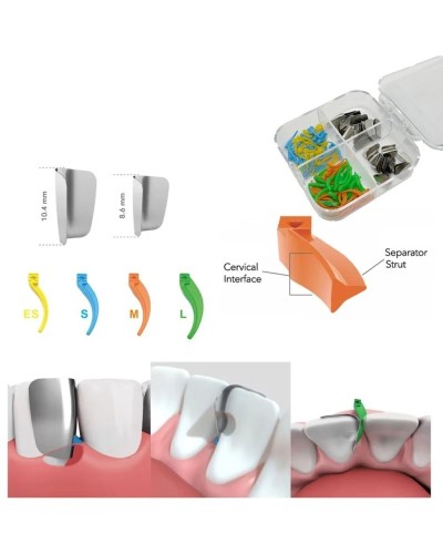 200Pcs Dental Wedges Anterior Matrix System Wedge Matrix Bands Interdental Wedges Dentist Supplies Oral Materials