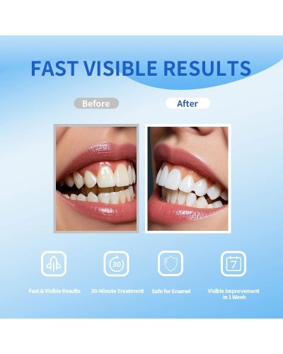 DrYadent Teeth Whitening Strips Enamel Safe&Peroxide-Free 14-Day Visible Results Sensitive Teeth Friendly Coffee Stains Removal