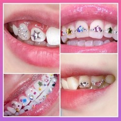 1set Dental Crystal Fashion Teeth Gems Beauty Diamond Tooth Jewelry Ornaments Tooth Gems Teeth Jewelry Gem Decoration