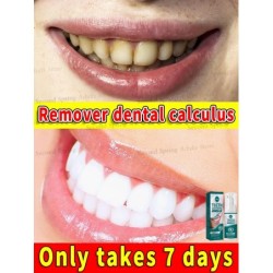 2025 Hot Products Teeth Whitening Mousse Removes Plaque and Stains Deep Cleans Fresh Breath Oral Hygiene Dental Tools