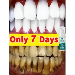 Tartar removers dissolve tartar and remove stains in 2025