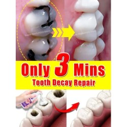 Solve all dental problem tooth decay repair tooth repair fast teeth whitening clean teeth teeth repair cavities